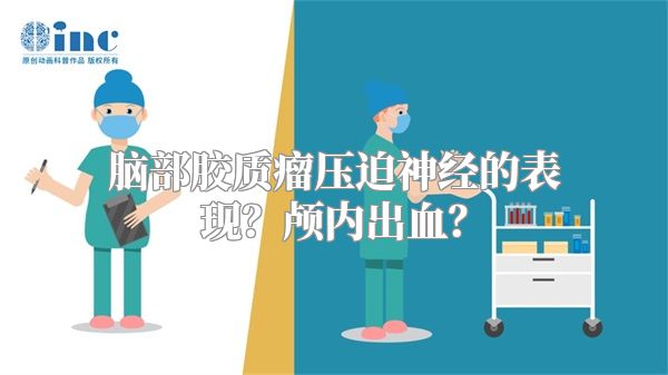 脑部胶质瘤压迫神经的表现？颅内出血？