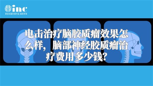 电击治疗脑胶质瘤效果怎么样，脑部神经胶质瘤治疗费用多少钱？