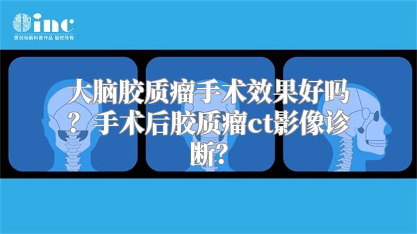 大脑胶质瘤手术效果好吗？手术后胶质瘤ct影像诊断？