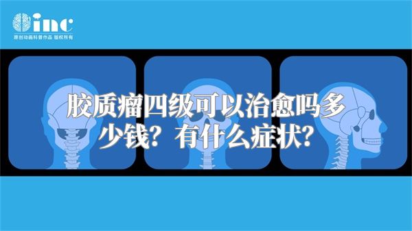 胶质瘤四级可以治愈吗多少钱？有什么症状？