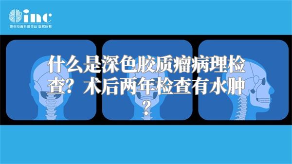 什么是深色胶质瘤病理检查？术后两年检查有水肿？