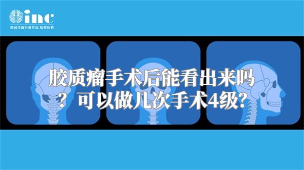 胶质瘤手术后能看出来吗？可以做几次手术4级？