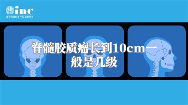 脊髓胶质瘤长到10cm一般是几级