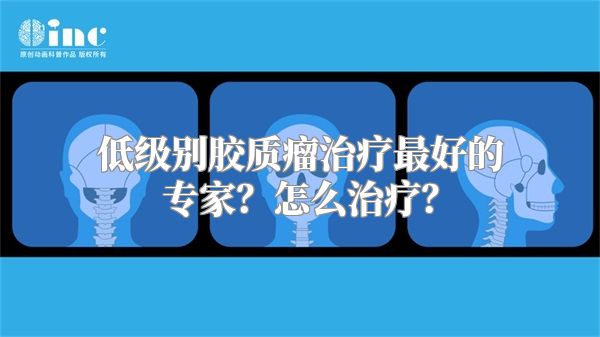 低级别胶质瘤治疗最好的专家？怎么治疗？