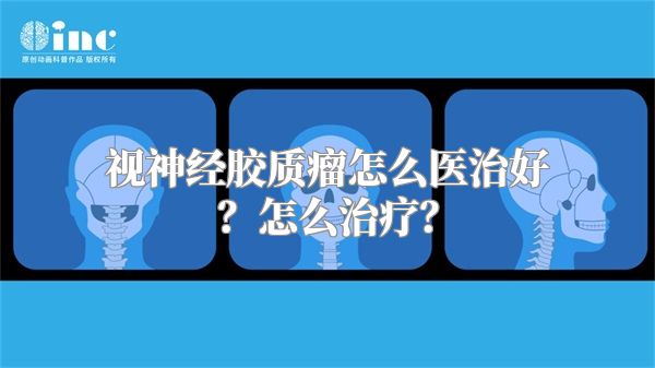 视神经胶质瘤怎么医治好？怎么治疗？