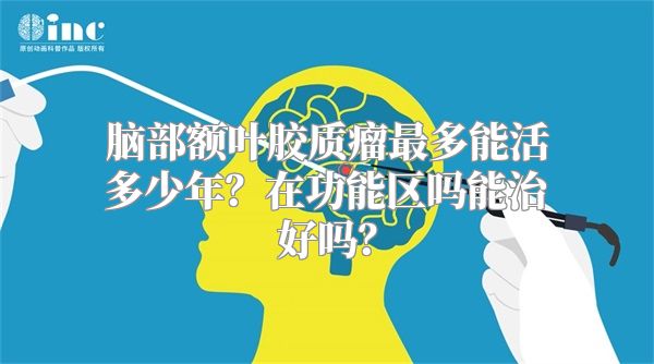 脑部额叶胶质瘤最多能活多少年？在功能区吗能治好吗？