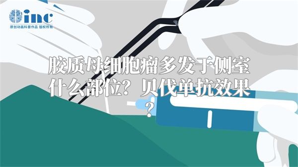 胶质母细胞瘤多发于侧室什么部位？贝伐单抗效果？