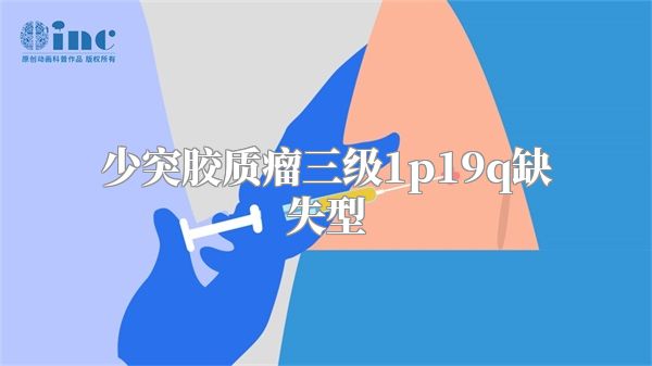 少突胶质瘤三级1p19q缺失型