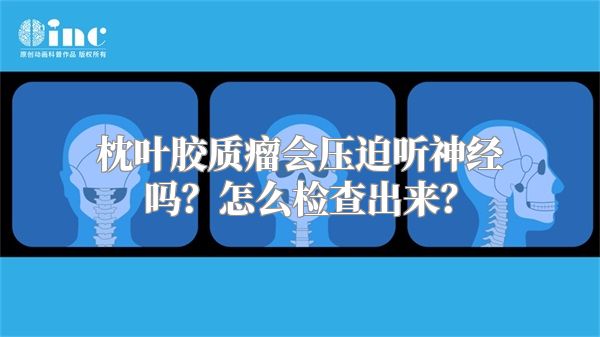 枕叶胶质瘤会压迫听神经吗？怎么检查出来？