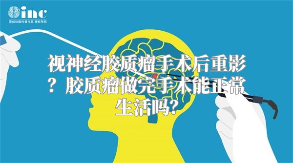 视神经胶质瘤手术后重影？胶质瘤做完手术能正常生活吗？