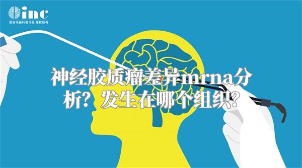 神经胶质瘤差异mrna分析？发生在哪个组织？