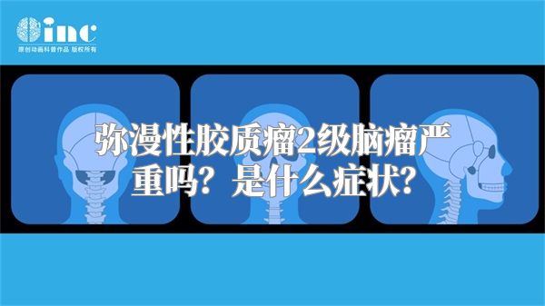 弥漫性胶质瘤2级脑瘤严重吗？是什么症状？