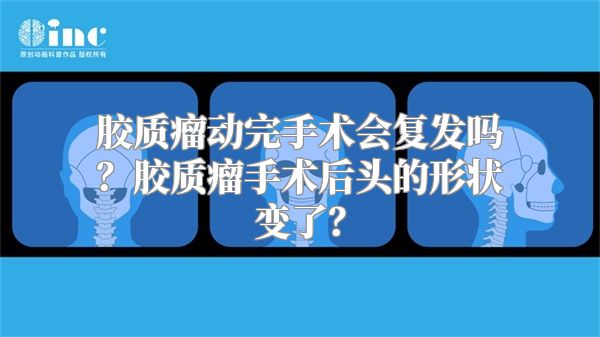 胶质瘤动完手术会复发吗？胶质瘤手术后头的形状变了？