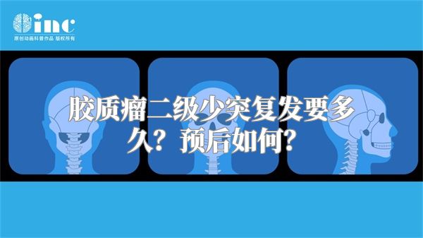 胶质瘤二级少突复发要多久？预后如何？