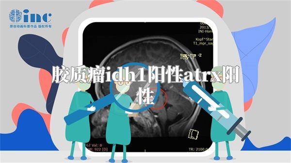 胶质瘤idh1阳性atrx阳性