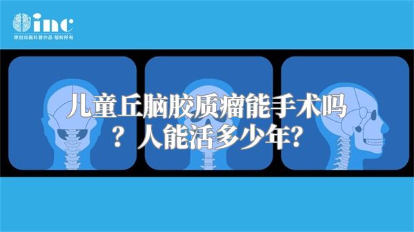 儿童丘脑胶质瘤能手术吗？人能活多少年？