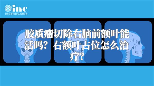 胶质瘤切除右脑前额叶能活吗？右额叶占位怎么治疗？