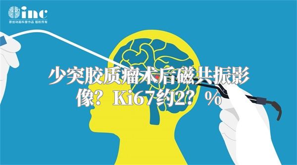 少突胶质瘤术后磁共振影像？Ki67约2？%