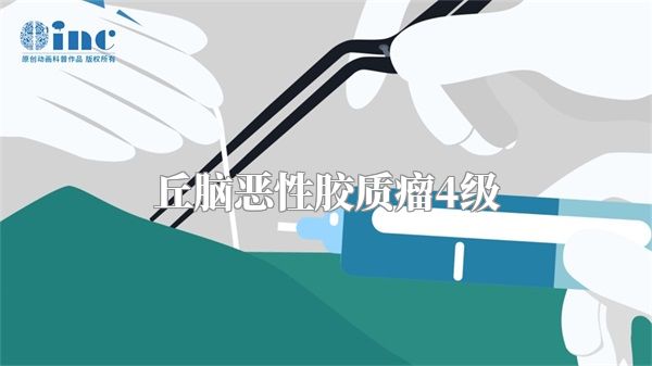 丘脑恶性胶质瘤4级