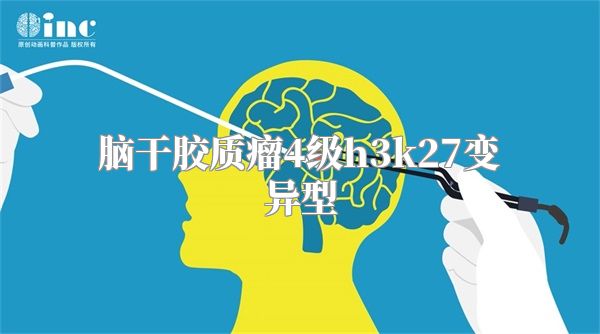 脑干胶质瘤4级h3k27变异型