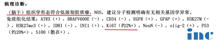 脑干-桥臂胶质瘤病理诊断