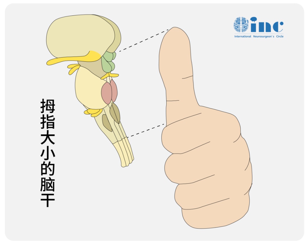 【近10位患者真实案例】这种胶质瘤可以做“更好”全切手术