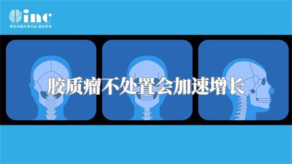 胶质瘤不处置会加速增长