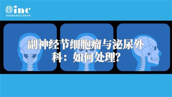 副神经节细胞瘤与泌尿外科：如何处理？