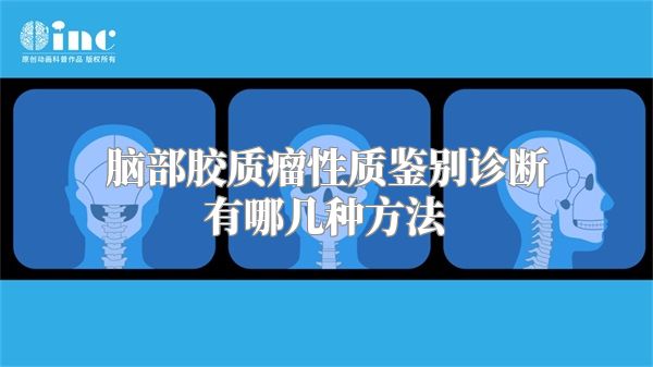 脑部胶质瘤性质鉴别诊断有哪几种方法