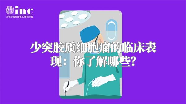 少突胶质细胞瘤的临床表现：你了解哪些？