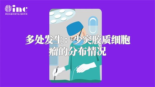 多处发生：少突胶质细胞瘤的分布情况