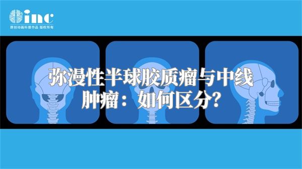 弥漫性半球胶质瘤与中线肿瘤：如何区分？