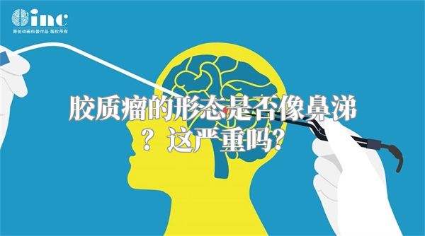 胶质瘤的形态是否像鼻涕？这严重吗？