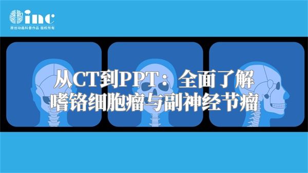 从CT到PPT：全面了解嗜铬细胞瘤与副神经节瘤