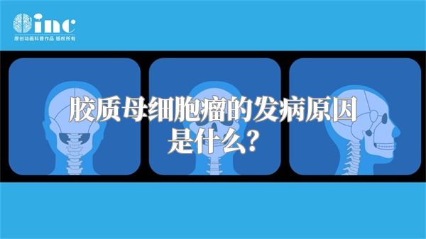 胶质母细胞瘤的发病原因是什么？