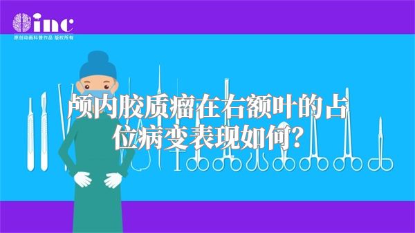 颅内胶质瘤在右额叶的占位病变表现如何？