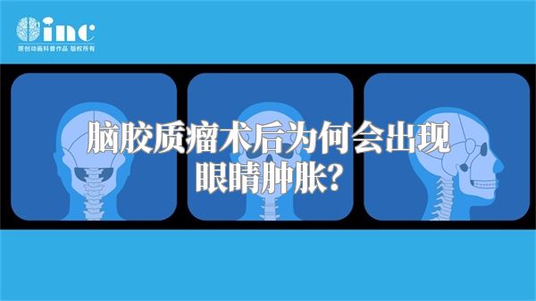 脑胶质瘤术后为何会出现眼睛肿胀？