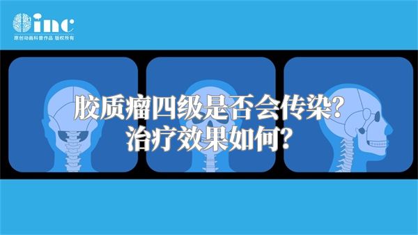 胶质瘤四级是否会传染？治疗效果如何？