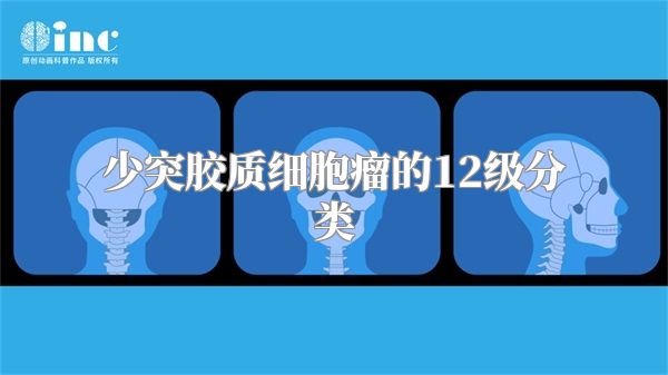 少突胶质细胞瘤的12级分类