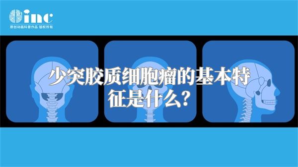 少突胶质细胞瘤的基本特征是什么？