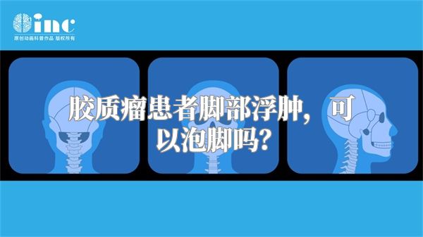 胶质瘤患者脚部浮肿，可以泡脚吗？