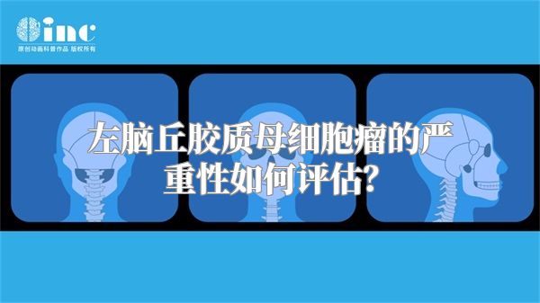 左脑丘胶质母细胞瘤的严重性如何评估？