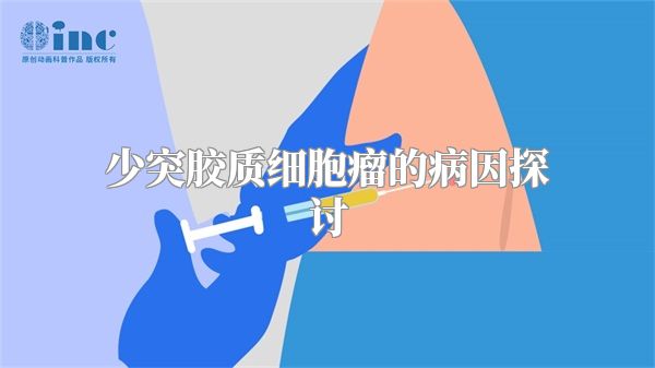 少突胶质细胞瘤的病因探讨