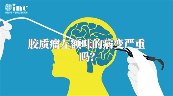 胶质瘤左额叶的病变严重吗？