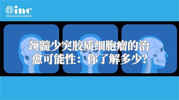 颈髓少突胶质细胞瘤的治愈可能性：你了解多少？