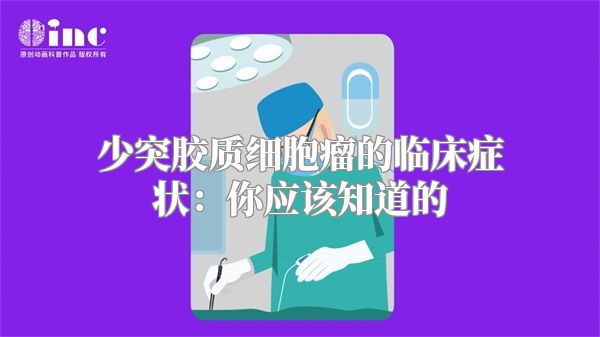 少突胶质细胞瘤的临床症状：你应该知道的