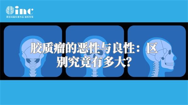 胶质瘤的恶性与良性：区别究竟有多大？