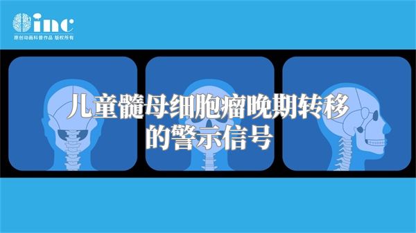 儿童髓母细胞瘤晚期转移的警示信号