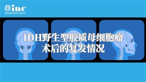 IDH野生型胶质母细胞瘤术后的复发情况