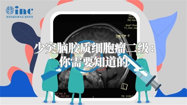 少突脑胶质细胞瘤二级：你需要知道的